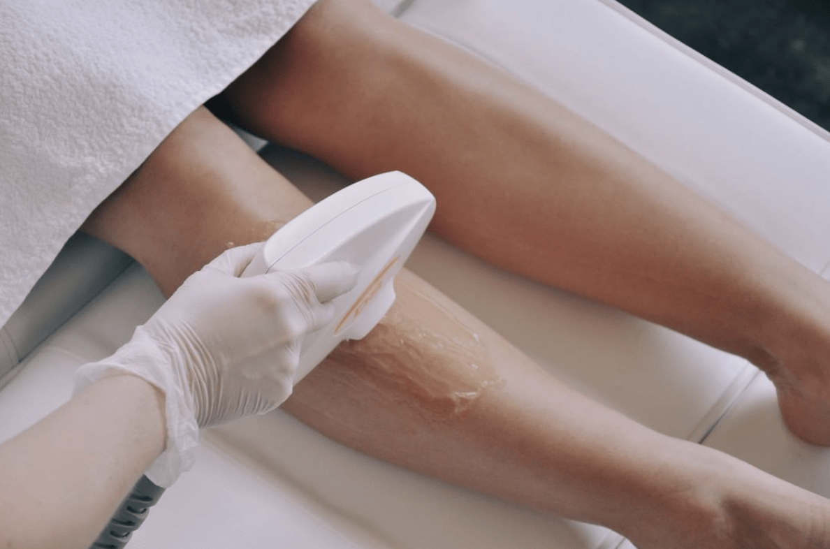 Laserbehandeling foto2